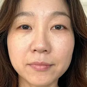 リンカーブ AFTER