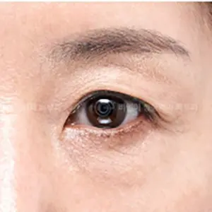 上下表ハムラ BEFORE