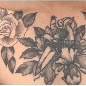 タトゥー除去 BEFORE