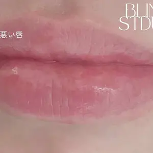 リップアート BEFORE