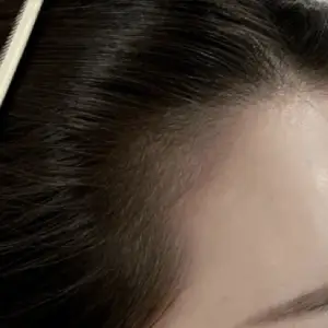 ヘアラインアートメイク AFTER