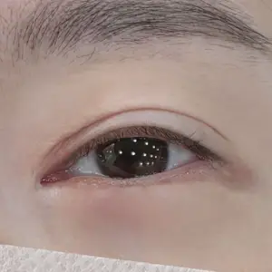 アイラインアートメイク BEFORE