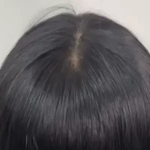 ヘアラインアートメイク AFTER