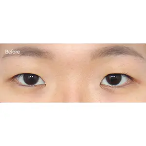 切開+トリム成形 BEFORE