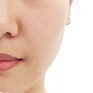 AIスキンブースター BEFORE