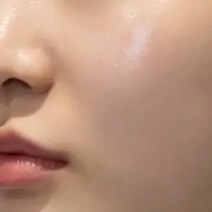 リジュラン AFTER