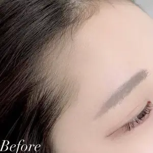 ヘアラインアートメイク BEFORE