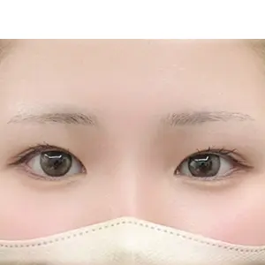 眉アートメイク BEFORE