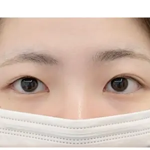 眉アートメイク BEFORE