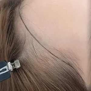 ヘアライン BEFORE