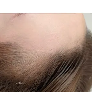 ヘアライン AFTER