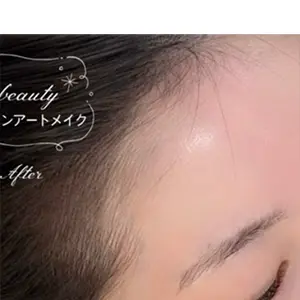 ヘアライン AFTER