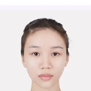 目の整形 BEFORE