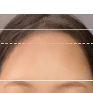 額縮小 BEFORE