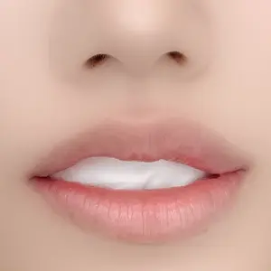 LIP BEFORE