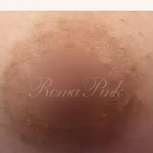 ROMAPINKROMAPINK BEFORE