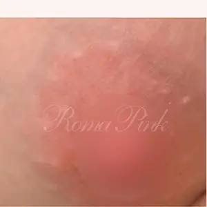 ROMAPINKROMAPINK AFTER