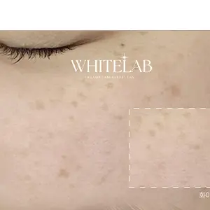 WHITELAB BEFORE