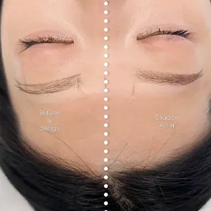 Retouch