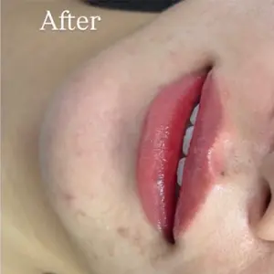 リップアートメイク AFTER