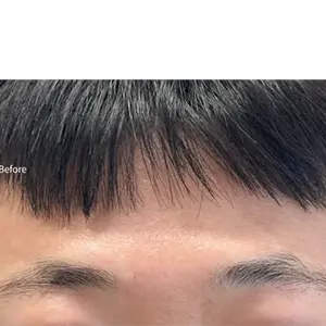 眉アートメイク BEFORE