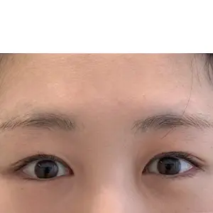眉アートメイク BEFORE