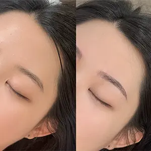 Retouch
