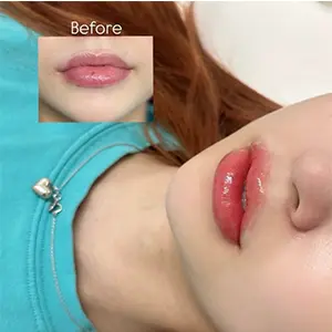 Retouch