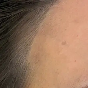 ヘアライン AFTER