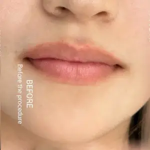 リップアート BEFORE