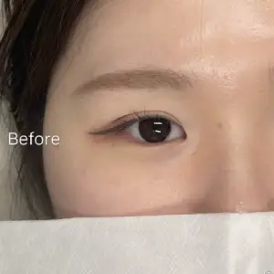涙袋アートメイク BEFORE