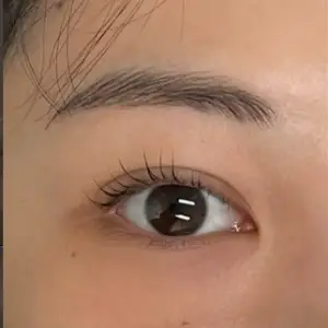 涙袋アートメイク BEFORE