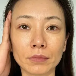 リンカーブ BEFORE