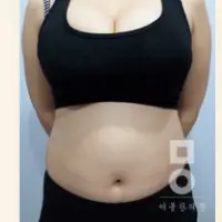 ピンク丸剤 BEFORE