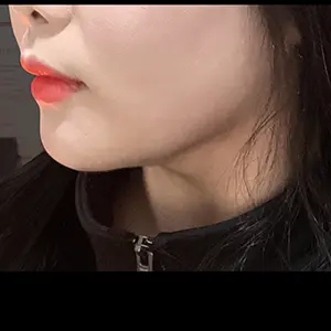 フェイスライン AFTER