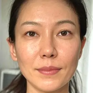 リンカーブ AFTER