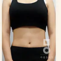 ピンク丸剤 AFTER