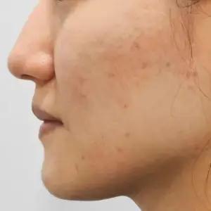 ポテンツァ＋ジュべルック AFTER