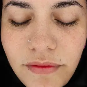 レブライト AFTER