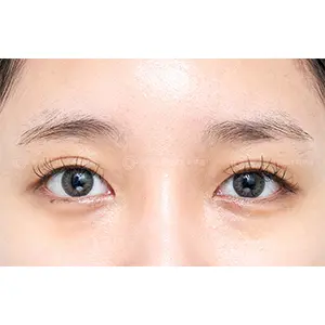 アイブロウ BEFORE