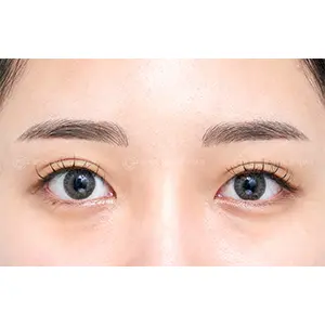 アイブロウ AFTER