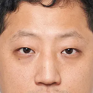 眉毛アート BEFORE