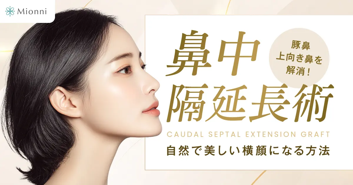 鼻中隔延長術