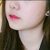 アキュリフト BEFORE