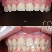 ラミネート BEFORE