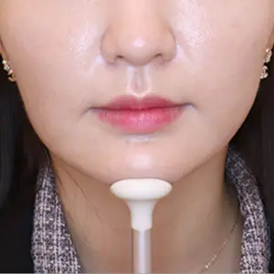 VCAT+頬骨CAT BEFORE